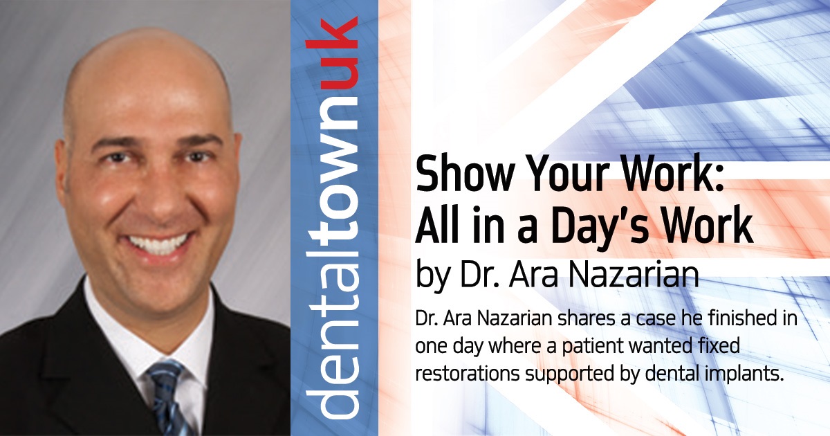 Show Your Work: All in a Day’s Work Dr. Ara Nazarian shares a case he finished in one day where a patient wanted fixed restorations supported by dental implants.