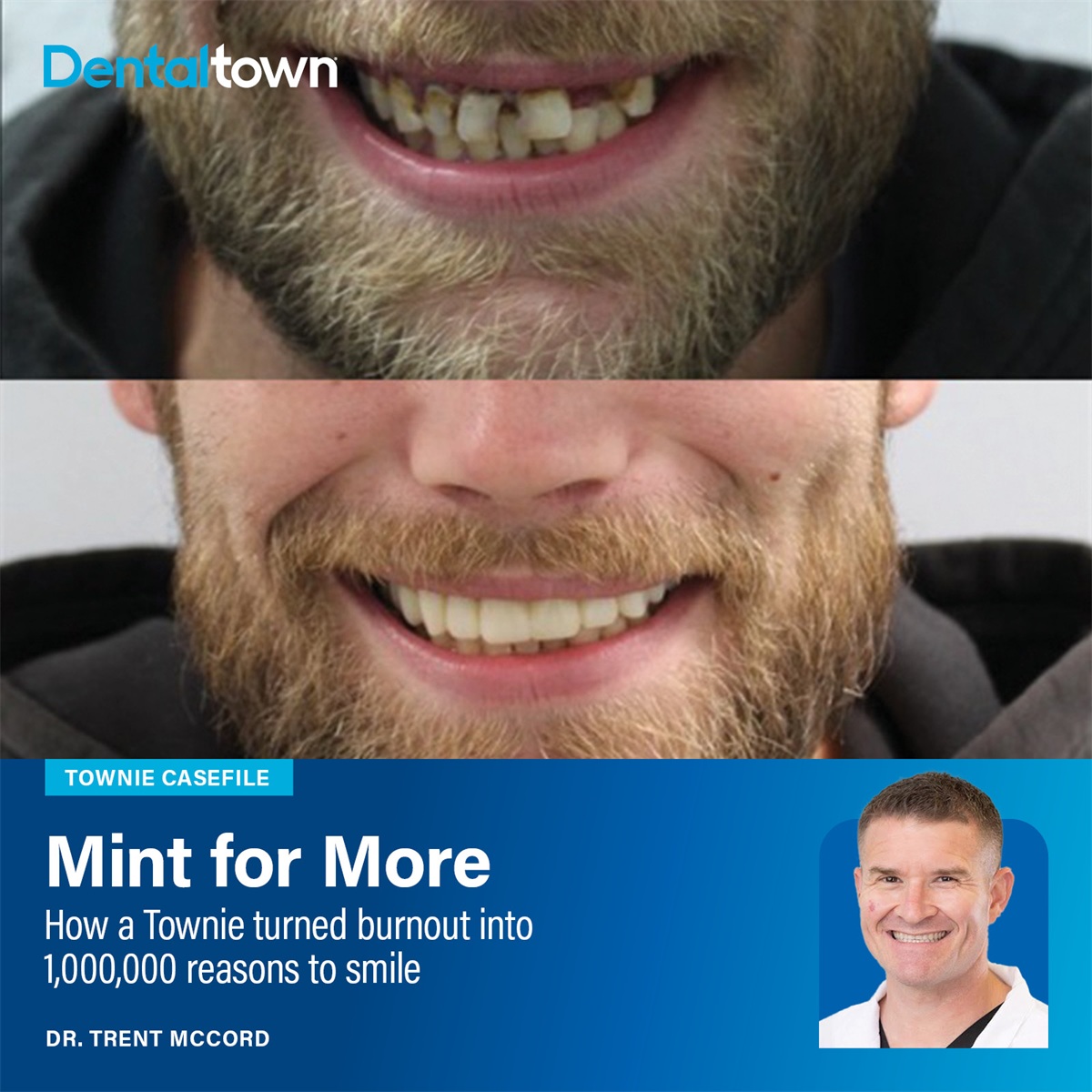 Townie Casefile: Mint for More Dr. Trent McCord shares how nonprofit care, digital dentures, and weekly free-clinic days helped him rebuild his practice, his purpose, and nearly $1 million in donated dentistry.