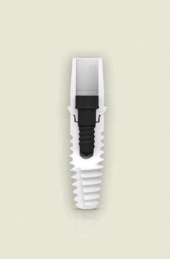 Glidewell Dental Launches Zeramex XT Implant 
