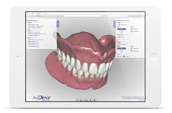 Dentsply Sirona and AvaDent enter into a Strategic Collaboration