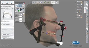 Whip Mix Announces New Bellus3D Dental Pro Face Scanning Solution