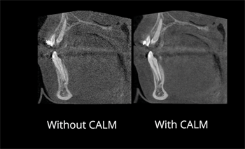 Planmeca Brings “CALM” to Imaging