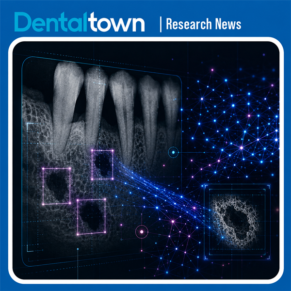 AI Model Shows Promise for Mapping Periodontal Bone Defects on Radiographs