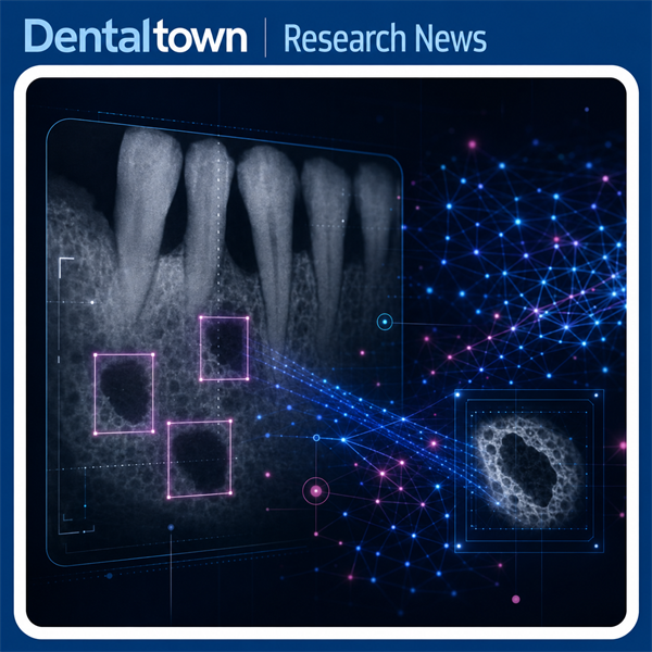 AI Model Shows Promise for Mapping Periodontal Bone Defects on Radiographs