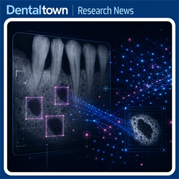 AI Model Shows Promise for Mapping Periodontal Bone Defects on Radiographs