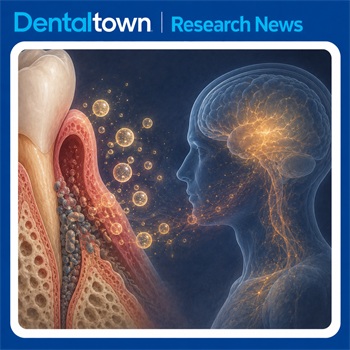 Gum Disease Bacteria Linked to Neuroinflammation in Preclinical Alzheimer's Study