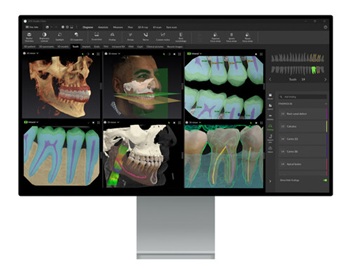 DEXIS Launches DTX Studio Clinic v4.7 With Expanded AI Imaging Tools