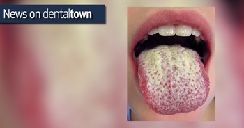 Does your tongue have a sense of smell?