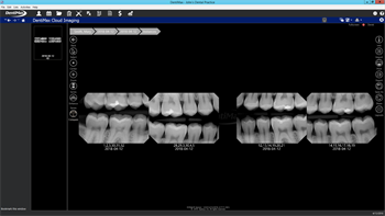 DentiMax Releases Cloud Imaging Software