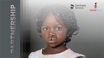 Dentsply Sirona and Smile Train Continue Efforts Together