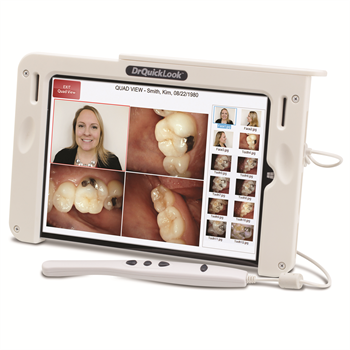 DrQuickLook Redesigns Intraoral Camera System