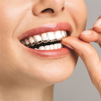 Assured Dental Lab Introduces DreamAligners