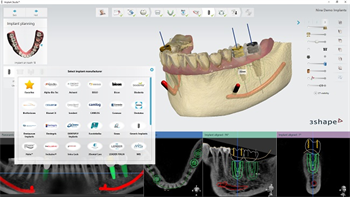 3Shape Releases Implant Studio 2016
