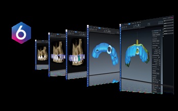Planmeca USA Launches Redesigned Planmeca Romexis 6.0
