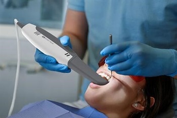 Intelliscan Launches AI-enabled Intraoral Scanner: INTELLISCAN 3D
