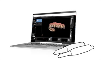 IO Scanner Link Gives Practitioners More Choice and Easier Access to Intraoral Scans