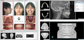 InnSoft Announces New Software, Ortho Share 3D