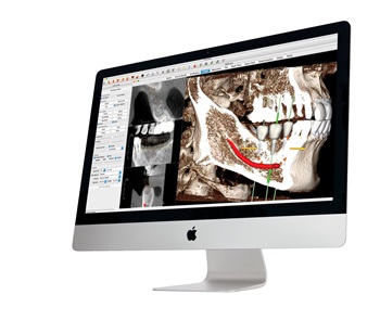 Anatomage Launches New 3D Dental Business