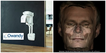 Owandy Radiology’s I-Max 3D Receives FDA 510 (k) Clearance