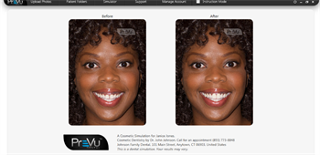 PreVu Launches New Software to Help Dental Professionals Initiate More Cosmetic Consultations