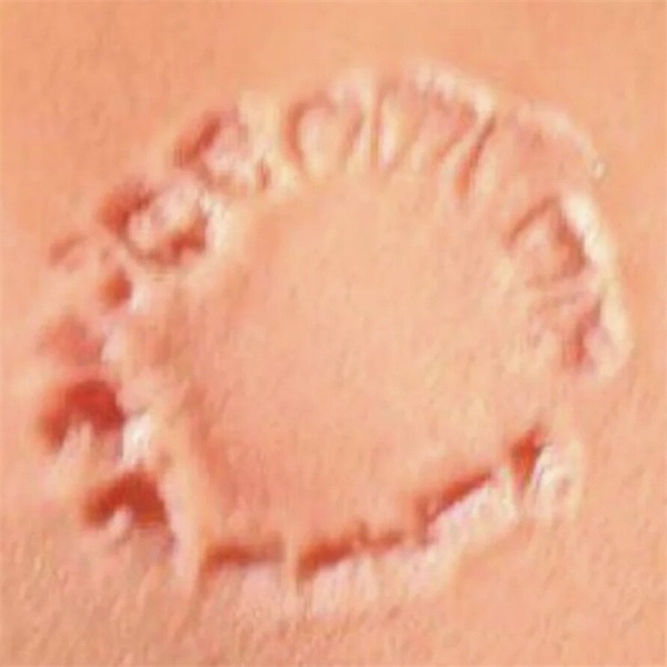 Puka Nacua Bite Mark Lawsuit Raises Questions About Forensic Odontology