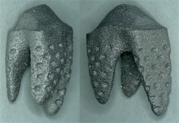 Natural Dental Implants AG Announces 3-D Printed Replicate Tooth at International Dental Show