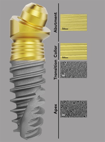Nobel BioCare Launches New Xeal and TiUltra Surfaces in U.S.