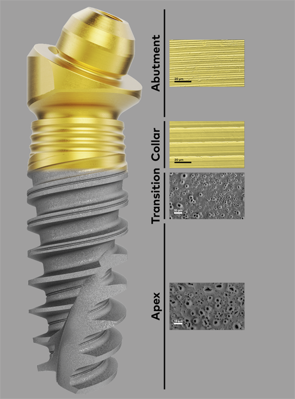 Nobel BioCare Launches New Xeal and TiUltra Surfaces in U.S.