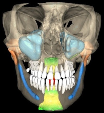 VELMENI Receives FDA 510(k) Clearance for 3D CBCT Dental Imaging Software
