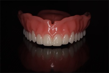 Assured Dental Lab Launches Evolution Digital Dentures