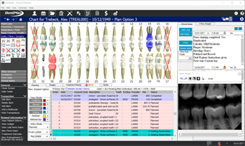 DentiMax Announces Upgrade to its Practice Management Software