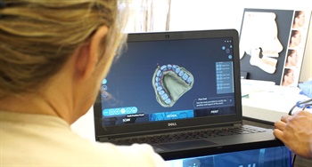 Ivory Digital Denture Announces Global Availability of Digital ‘Denture Clinic in a Box'
