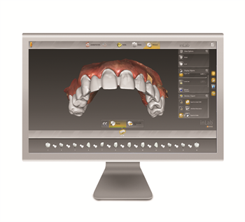 Sirona Introduces Completely Revised inLabSoftware 15