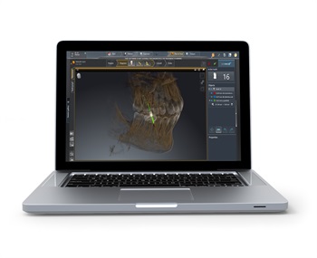 Dentsply Sirona Unveils Sicat Endo 3D Software at CDA Meeting in Anaheim