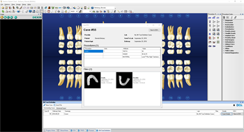 3M Launches New Trusted Connection for 3M True Definition Scanner