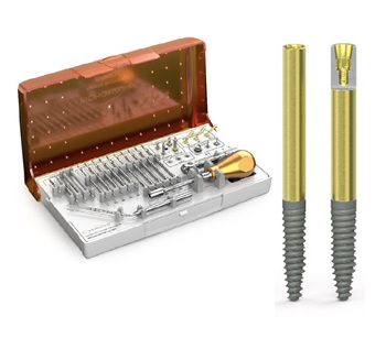 BioHorizons Launches Pro Zygoma Zygomatic Implant for Full-Arch Cases