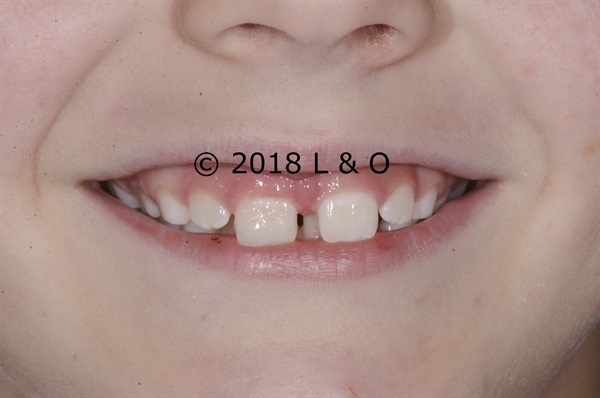 Answers to questions about Pediatric Orthodontics