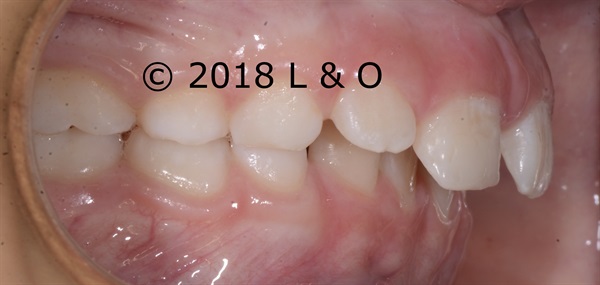 Answers to questions about Pediatric Orthodontics
