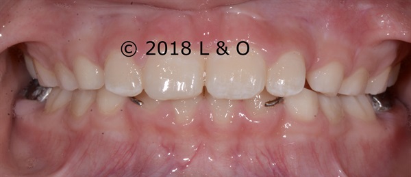 Answers to questions about Pediatric Orthodontics