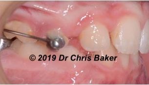 Upside Down and Inside Out: The New Wisdom in Orthodontic Treatment