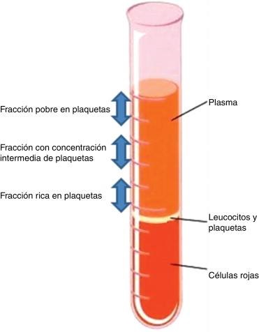 IMPLANTOLOGÍA DENTAL MÍNIMAMENTE INTEGRAL DR REY GIL