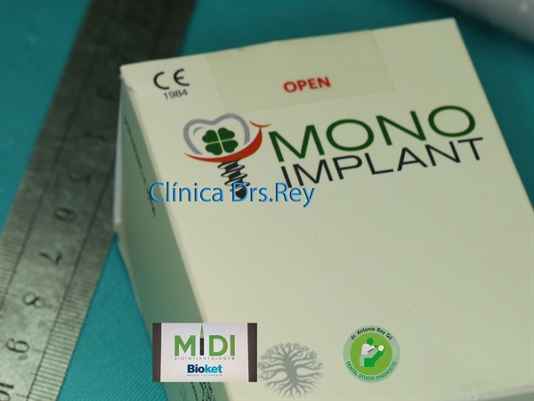 IMPLANTOLOGÍA DENTAL MÍNIMAMENTE INTEGRAL DR REY GIL