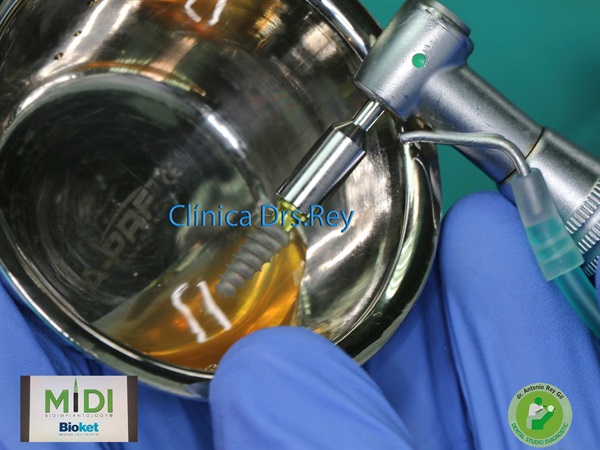 IMPLANTOLOGÍA DENTAL MÍNIMAMENTE INTEGRAL DR REY GIL