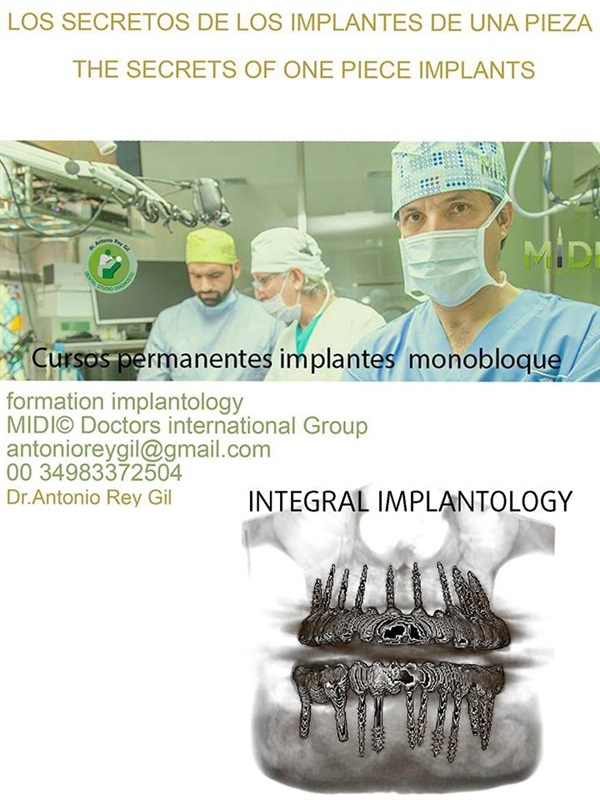 IMPLANTOLOGÍA DENTAL MÍNIMAMENTE INTEGRAL DR REY GIL