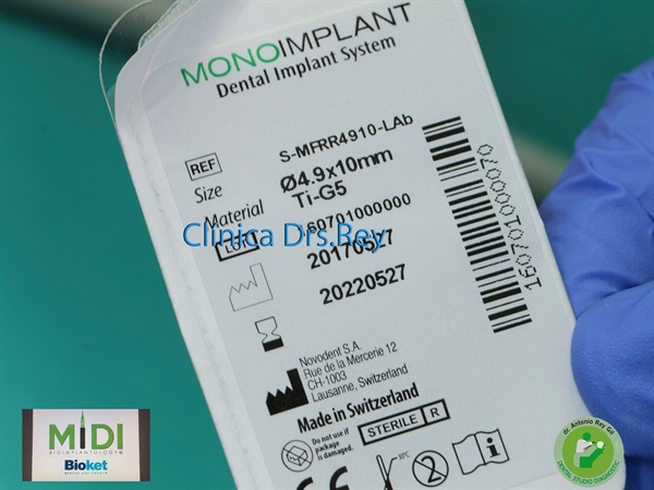 IMPLANTOLOGÍA DENTAL MÍNIMAMENTE INTEGRAL DR REY GIL