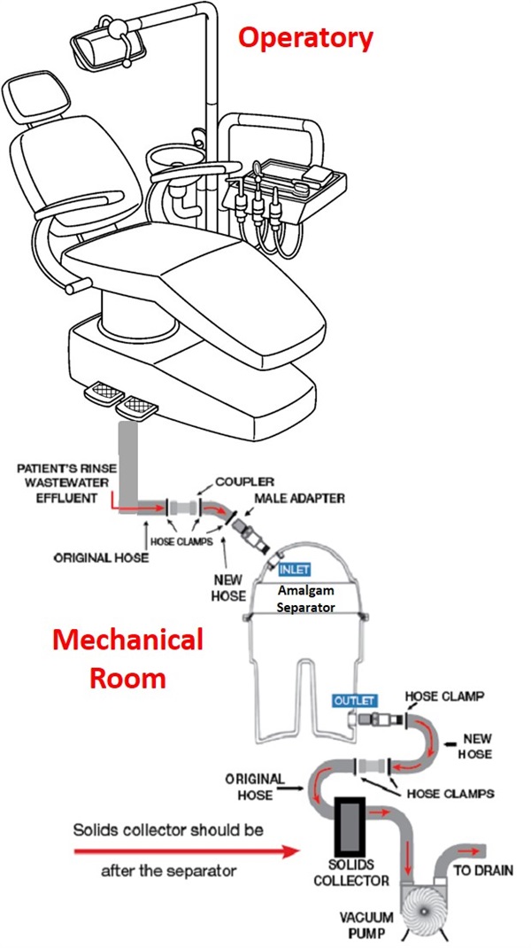 M.A.R.S Answers the Question “What is an Amalgam Separator?” – Part 1