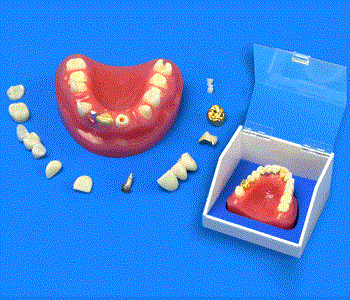 OUR ESTORATION DENTAL MODEL SHOWS VORIETY MOST FREQUENT TECHNIQUES COMBINATIONS USED BY DENTAL DOCTORS