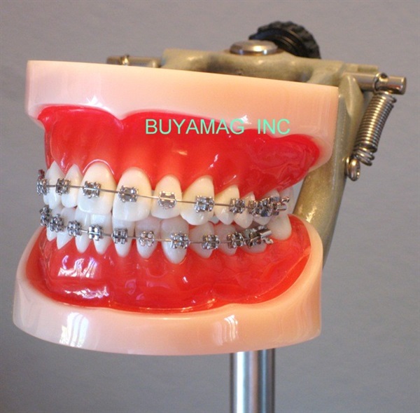 Orthodontic Models Precisely Provided By Buyamag Inc Teaching Manikin In Dental Schools. Models Available are of Class I, II and III Malocclusion, All Teeth With Perfect Morphology 