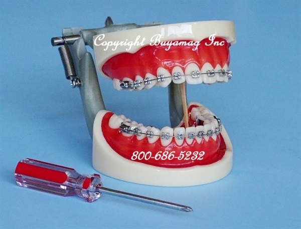 Orthodontic Models Precisely Provided By Buyamag Inc Teaching Manikin In Dental Schools. Models Available are of Class I, II and III Malocclusion, All Teeth With Perfect Morphology 