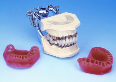 When it comes to Hygiene Models Periodontal Models Buyamag Inc Best Resource In Dental Schools. They Show Plug Build Up Cleaning Area To Maintain Oral Health   